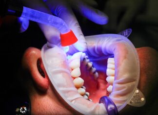 Jak utrzymać zdrowe zęby przez całe życie: Praktyczne porady